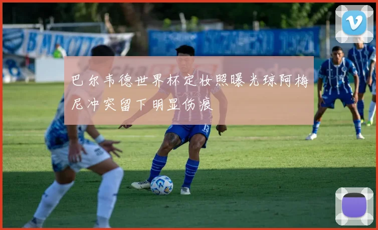 巴尔韦德世界杯定妆照曝光琼阿梅尼冲突留下明显伤痕